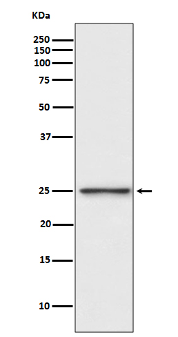 WB - Anti-PGP9.5 Rabbit Monoclonal Antibody ABO13863